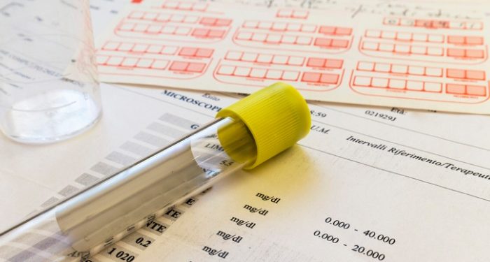 Regione Puglia: Esenzioni del ticket sanitario per reddito: proroga fino al 30 aprile