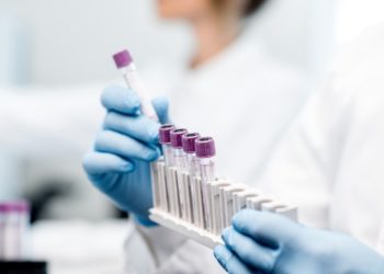 Caschi e delle calotte refrigeranti per contrastare gli effetti della chemioterapia: la Giunta approva gli indirizzi operativi