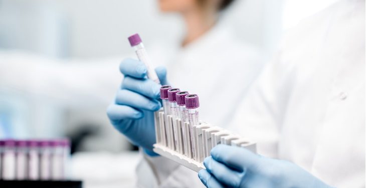 Caschi e delle calotte refrigeranti per contrastare gli effetti della chemioterapia: la Giunta approva gli indirizzi operativi