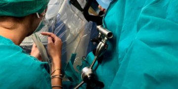 Policlinico di Bari, intervento di neurochirurgia pediatrica su un paziente sveglio